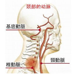颈部椎动脉图（颈动脉型颈椎病）